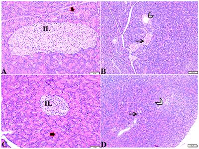 Melatonin downregulates the increased hepatic alpha-fetoprotein expression and restores pancreatic beta cells in a streptozotocin-induced diabetic rat model: a clinical, biochemical, immunohistochemical, and descriptive histopathological study